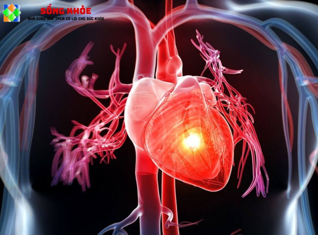 Biện pháp phòng tránh bệnh tim mạch?